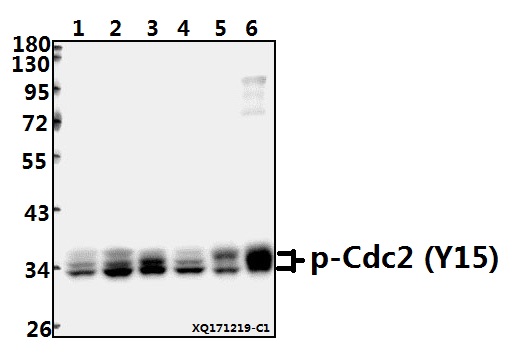 Western blot (WB) analysis of p-Cdc2 (Y15) pAb at 1:500 dilution
Lane1:MCF-7 whole cell lysate(40ug)
Lane2:HEK293T whole cell lysate(40ug)
Lane3:SGC7901 whole cell lysate(40ug)
Lane4:PC3 whole cell lysate(40ug)
Lane5:PC12 whole cell lysate(40ug)
Lane6:BV2 whole cell lysate(40ug)