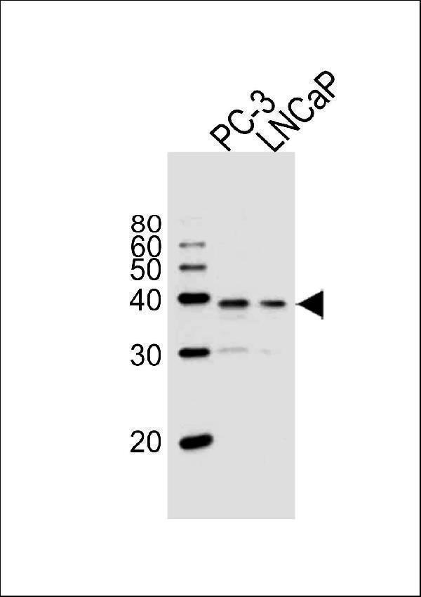 a00210 anti vdr antibody center wb testing 1