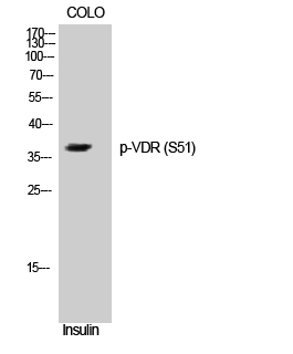 Western Blot analysis of COLO cells using Phospho-VDR (S51) Polyclonal Antibody cells nucleus extracted by Minute TM Cytoplasmic and Nuclear Fractionation kit 