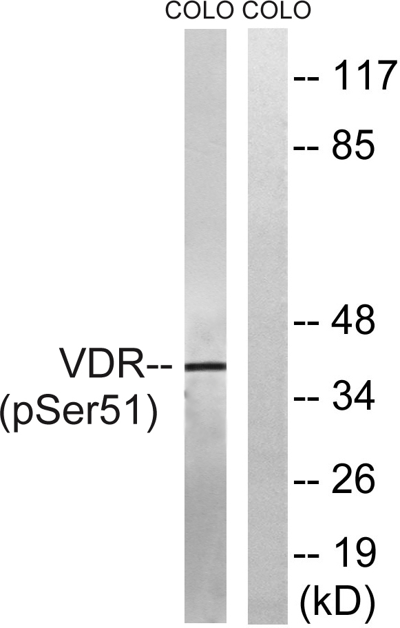 Western blot analysis of lysates from COLO205 cells treated with Insulin 0