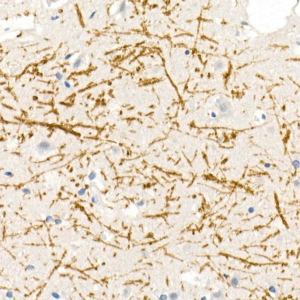 Immunohistochemistry of paraffin-embedded human brain using Myelin Basic Protein Rabbit pAb  at dilution of 1:25 