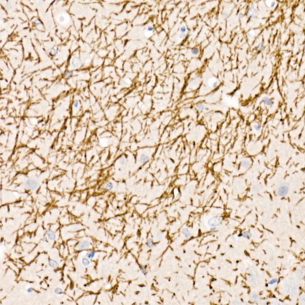 Immunohistochemistry of paraffin-embedded mouse brain using Myelin Basic Protein Rabbit pAb  at dilution of 1:25 
