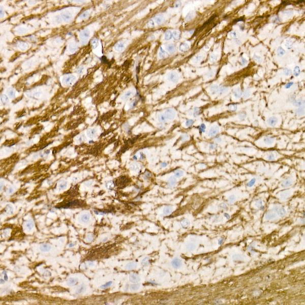 a00211 mbp primary antiboties ihc testing 4