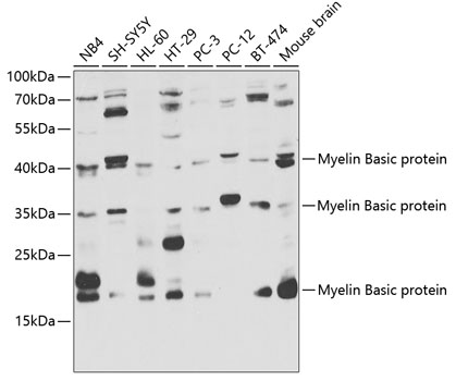 Western blot analysis of extracts of various cell lines, using Myelin Basic Protein  antibody  at 1:1000 dilution