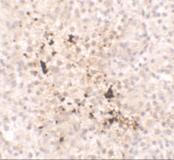 Immunohistochemistry of IL-15 in human spleen tissue with IL-15 antibody at 2