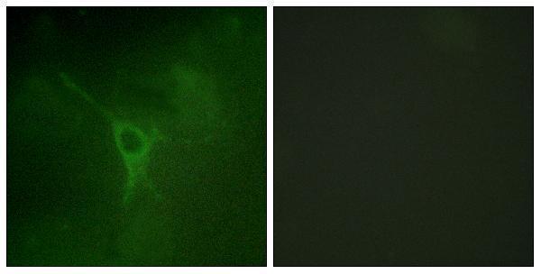 Immunofluorescence analysis of COS7 cells, using GFAP (Phospho-Ser38) Antibody