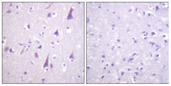 Immunohistochemistry analysis of paraffin-embedded human brain, using GFAP (Phospho-Ser38) Antibody