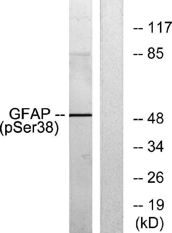 Western blot analysis of lysates from HeLa cells, using GFAP (Phospho-Ser38) Antibody