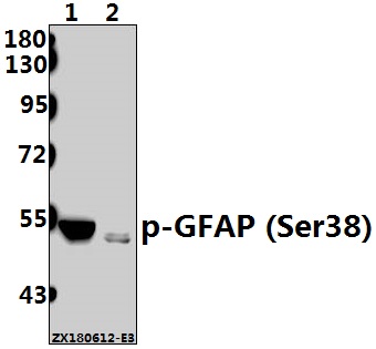 a00213s38 gfap primary antiboties wb testing 1