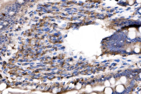  IHC analysis of IL-2 Receptor alpha/Il2ra using anti-IL-2 Receptor alpha/Il2ra antibody (A00214-1)