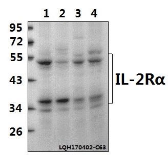Western blot (WB) analysis of IL-2Rα (R264) polyclonal antibody at 1:500 dilution
Lane1:PC3 whole cell lysate(40ug)
Lane2:A549 whole cell lysate(40ug)
Lane3:PMVEC whole cell lysate(40ug)
Lane4:BV2 whole cell lysate(40ug)