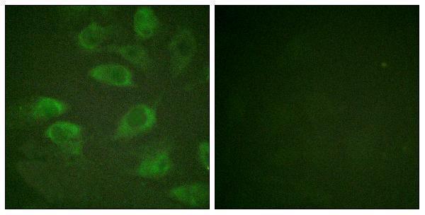 Immunofluorescence analysis of HeLa cells, using IL-2R alpha/CD25 (Phospho-Ser268) Antibody