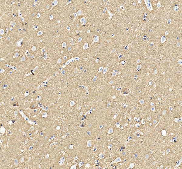  IHC analysis of Alpha Synuclein/SNCA using anti-Alpha Synuclein/SNCA antibody (A00215-3)