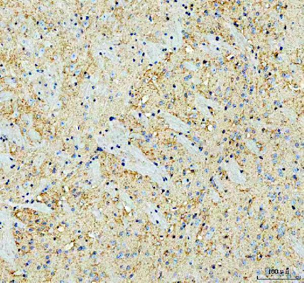  IHC analysis of Alpha Synuclein/SNCA using anti-Alpha Synuclein/SNCA antibody (A00215-3)