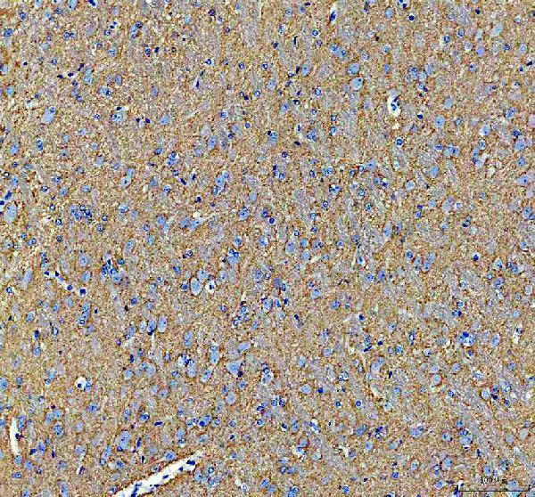 a00215 3 alpha synuclein snca primary antibodies ihc testing 4_1