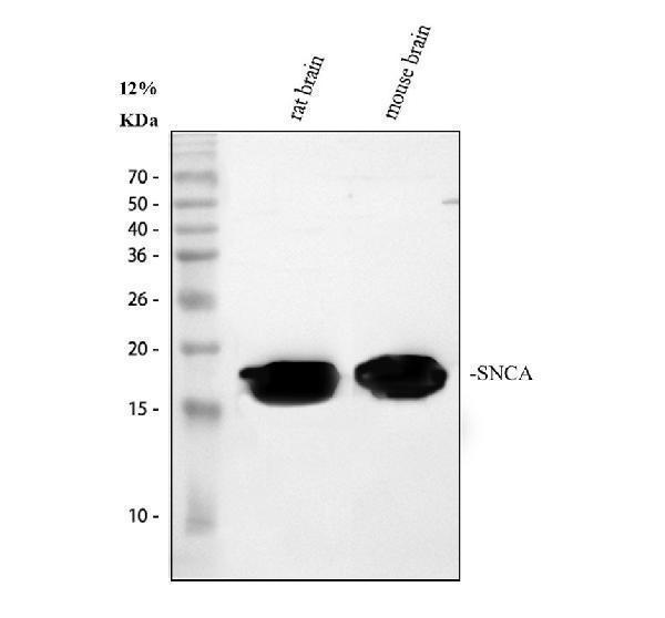  Western blot analysis of Alpha Synuclein/SNCA using anti-Alpha Synuclein/SNCA antibody (A00215-3)