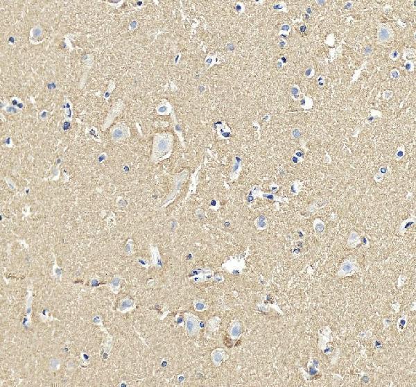a00215 3 snca primary antibodies ihc testing 5