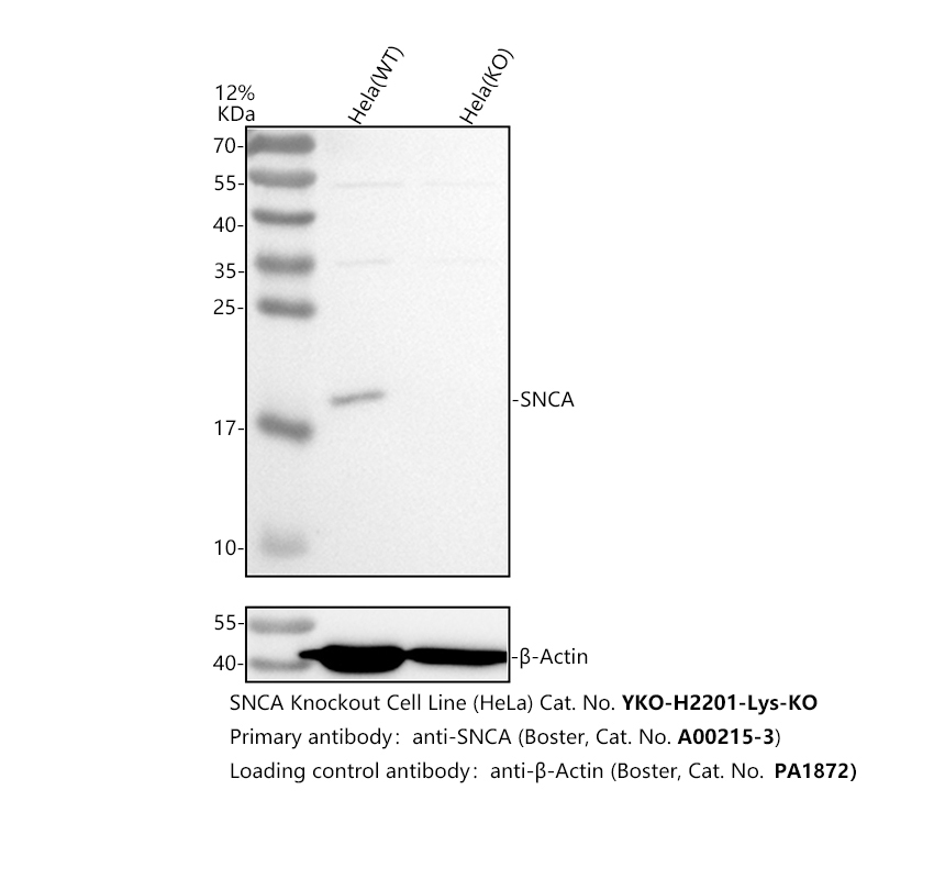 a00215 3 snca primary antibodies wb testing 2