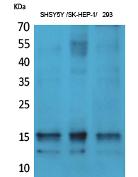 Western Blot analysis of various cells using Phospho-Synuclein-α (Y125) Polyclonal Antibody