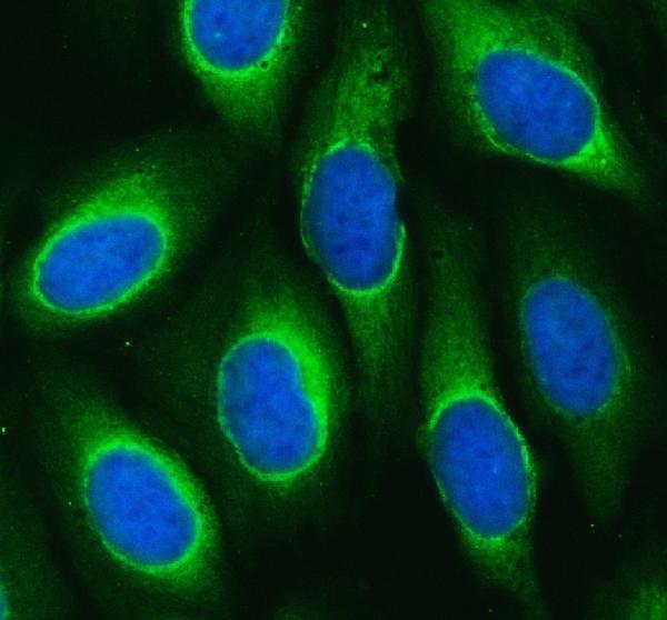 a00216 1 mars1 primary antibodies if testing 1
