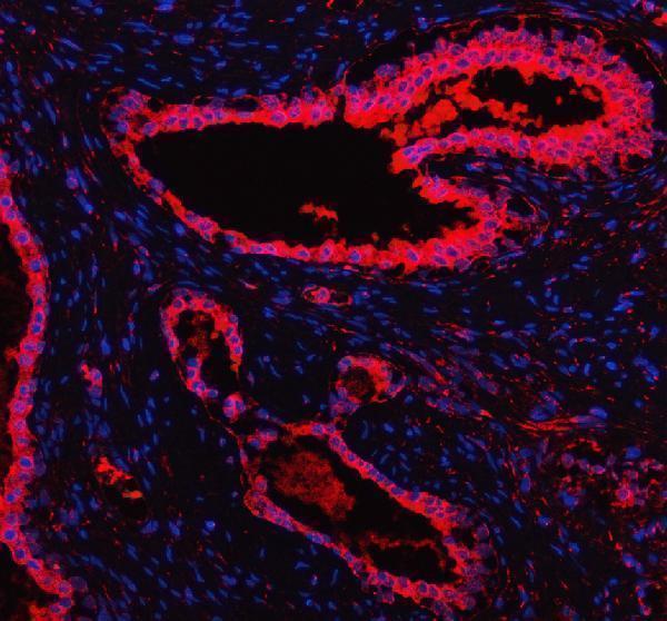 a00216 1 mars1 primary antibodies if testing 2