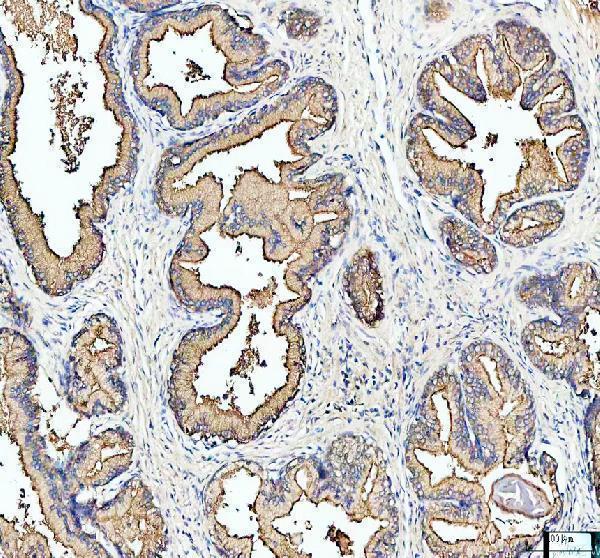 a00216 1 mars1 primary antibodies ihc testing 1