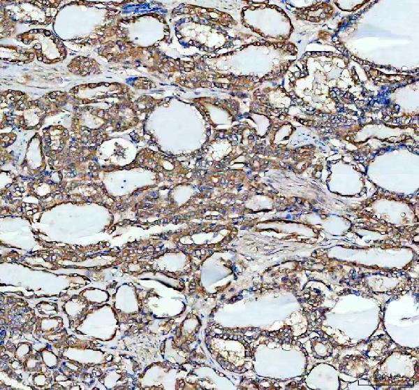 a00216 1 mars1 primary antibodies ihc testing 2