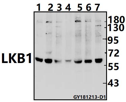 a00217 1 stk11 primary antiboties wb testing 1