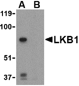 a00217 stk11 primary antibodies wb testing 1