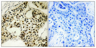 a00217s334 stk11 primary antibodies ihc testing 3
