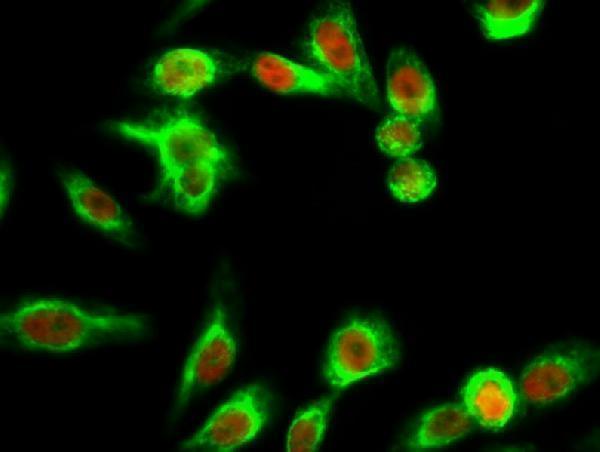 a00217s428 stk11 primary antibodies if testing 4