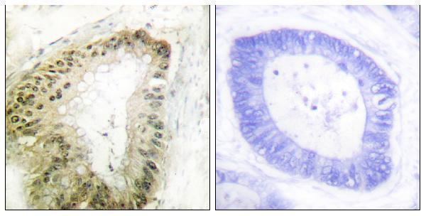 a00217s428 stk11 primary antibodies ihc testing 3