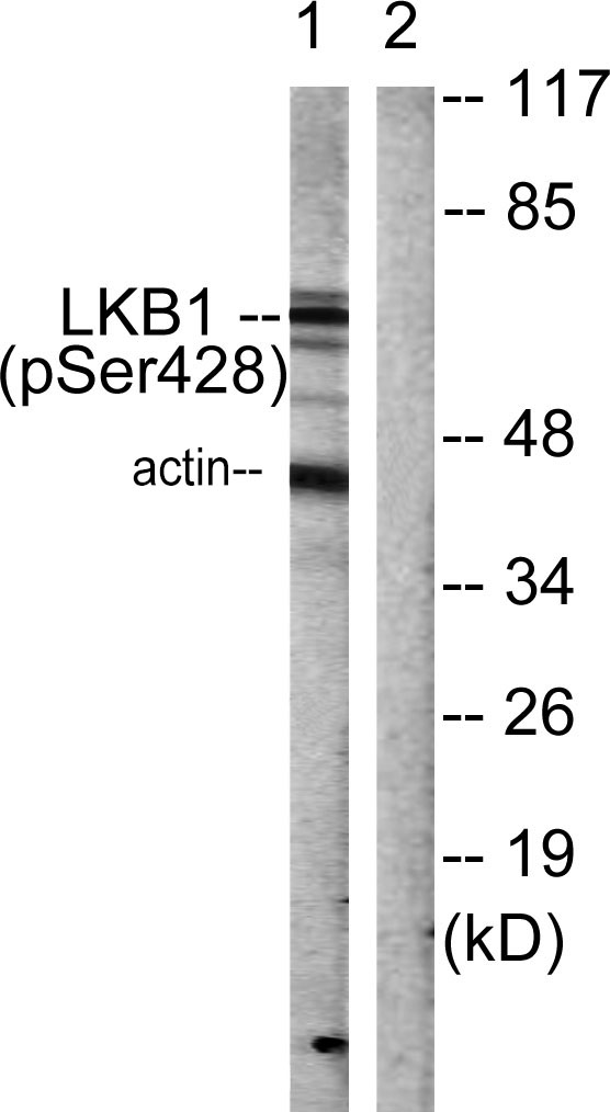 a00217s428 stk11 primary antibodies wb testing 2
