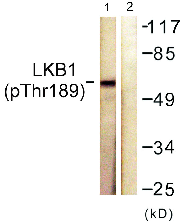 a00217t189 stk11 primary antibodies wb testing 3