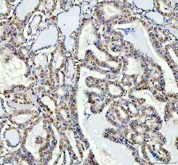 a00219 3 fto primary antibodies ihc testing 3_1
