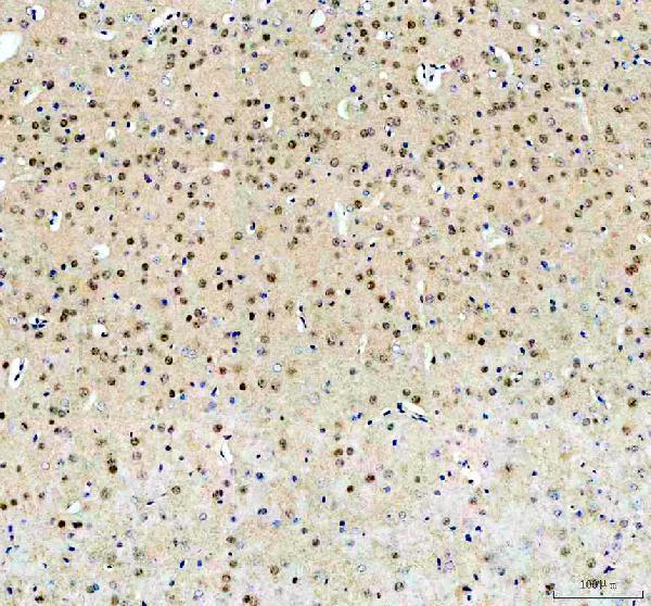 a00219 3 fto primary antibodies ihc testing 5_1