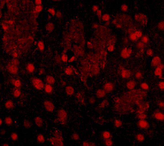 Immunofluorescence of FTO in Mouse Brain cells with FTO antibody at 20 μg/mL