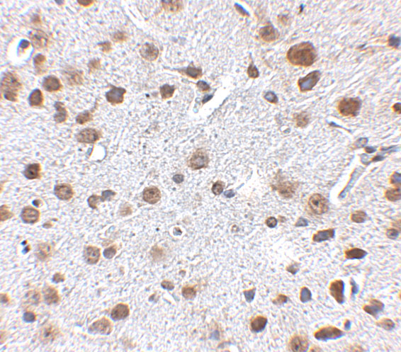 Immunohistochemistry of FTO in mouse brain tissue with FTO antibody at 2