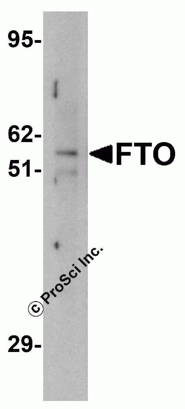 Western blot analysis of FTO in human uterus tissue lysate with FTO antibody at (A) 1 and (B) 2 μg/mL