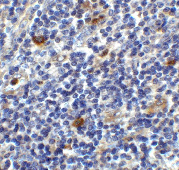 Immunohistochemistry of CD86 in human lymph node tissue with CD86 antibody at 2 μg/ml