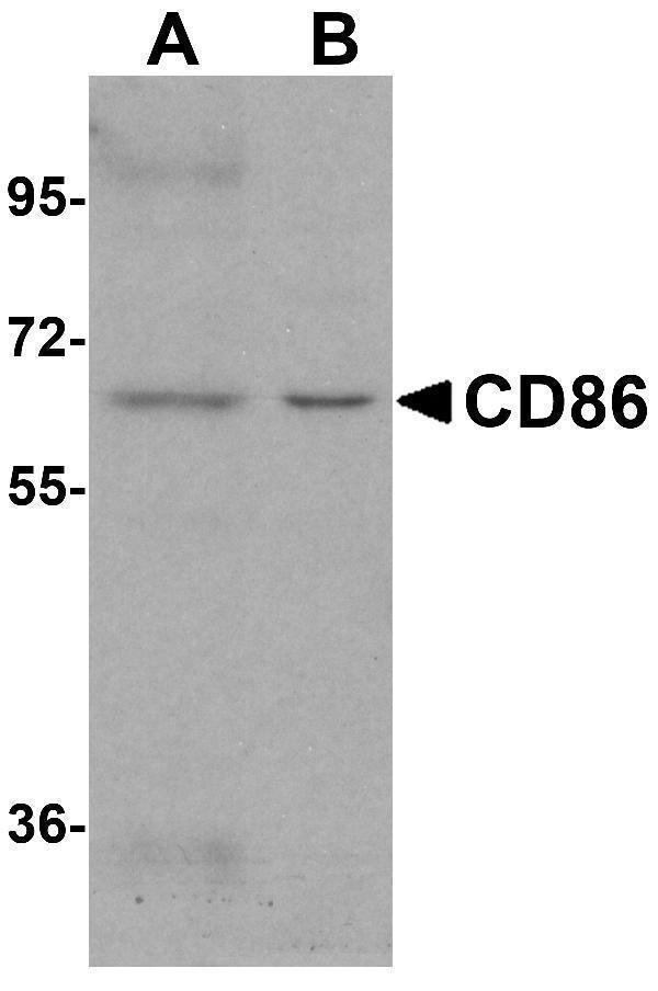Western blot analysis of CD86 in (A) Daudi and (B) Raji cell lysate with CD86 antibody at 1 μg/mL