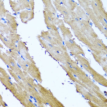 Immunohistochemistry of paraffin-embedded rat heart using SRI antibody at dilution of 1:100 (x40 lens)