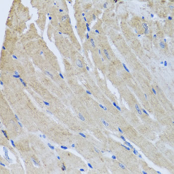 Immunohistochemistry of paraffin-embedded mouse heart using SRI antibody at dilution of 1:100 (x40 lens)