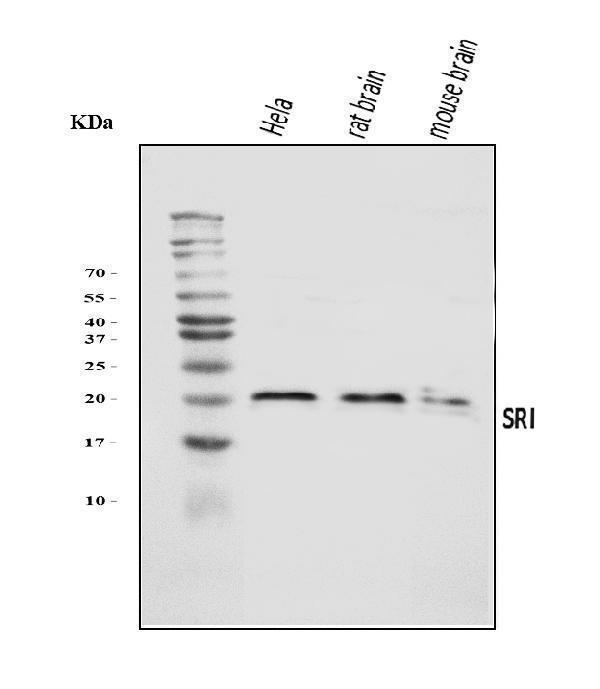  Western blot analysis of SRI using anti-SRI antibody (A00222-2)