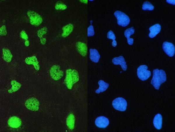 a00223 1 brg1 primary antibodies if testing 5