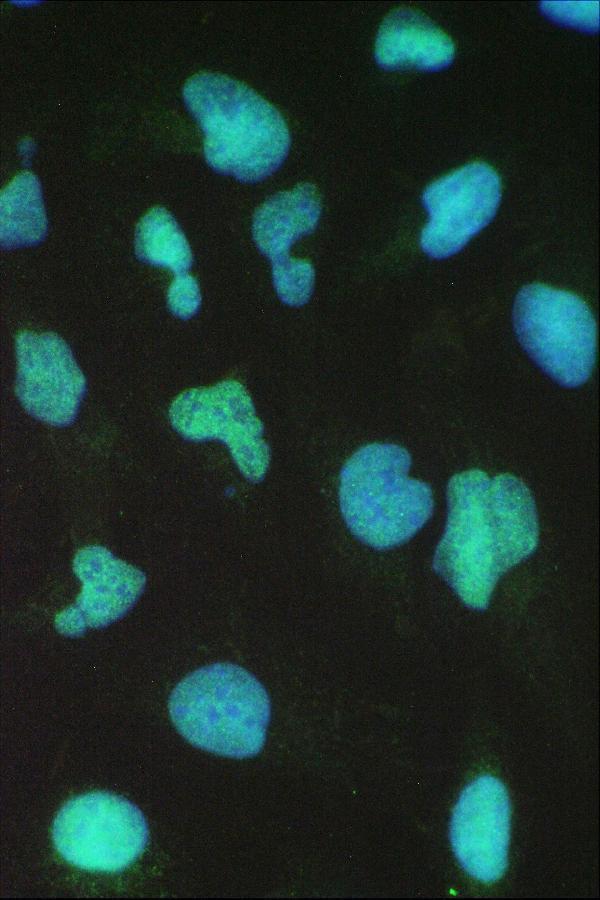 a00223 1 brg1 primary antibodies if testing 6