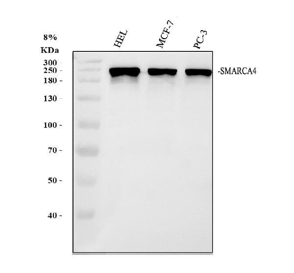 Western blot analysis of BRG1/SMARCA4 using anti-BRG1/SMARCA4 antibody (A00223-1)