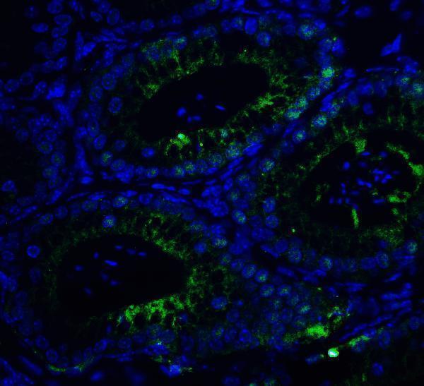 a00223 smarca4 primary antibodies if testing 5