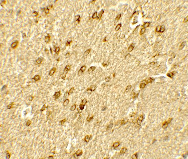 Immunohistochemistry of SMARCA4 in rat brain tissue with SMARCA4 antibody at 5 μg/mL