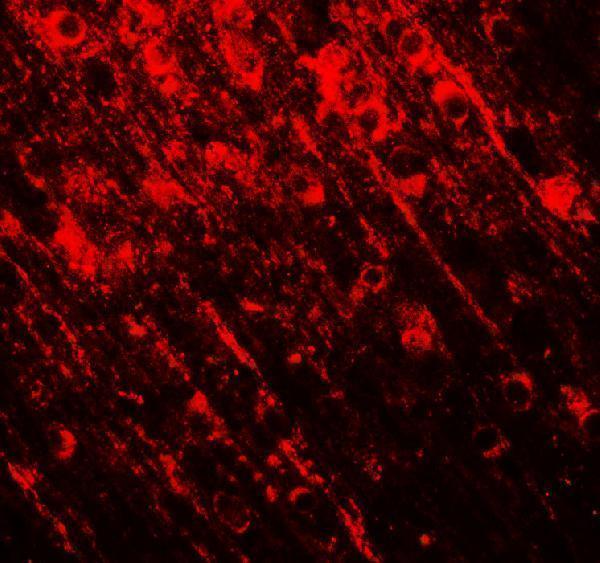 Immunohistochemistry of SMARCA4 in rat brain tissue with SMARCA4 antibody at 5 μg/mL